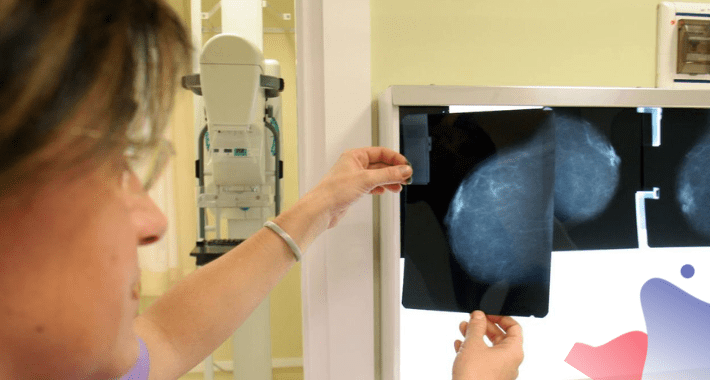 Tecnología, aliada vs cáncer de mama
