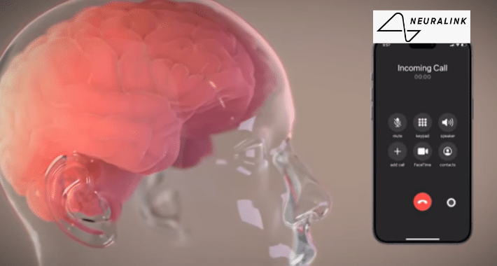 Neuralink coloca su primer dispositivo cerebral en un humano
